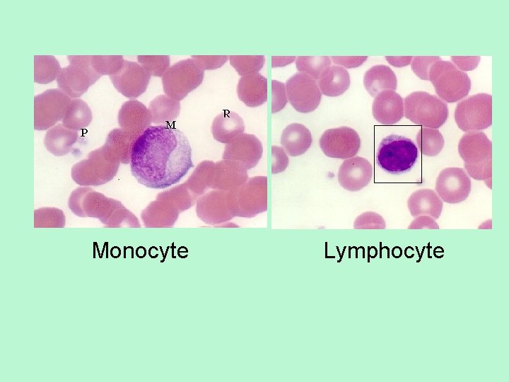 Monocyte Lymphocyte 
