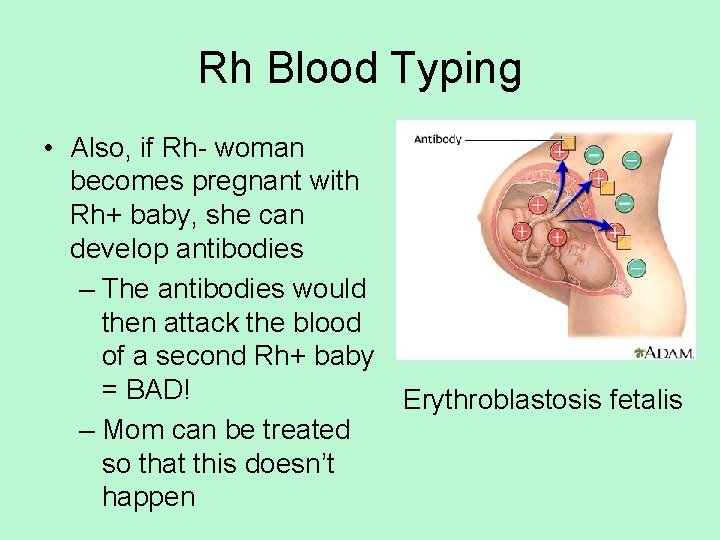 Rh Blood Typing • Also, if Rh- woman becomes pregnant with Rh+ baby, she