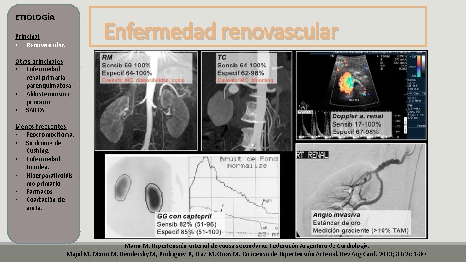 ETIOLOGÍA Enfermedad renovascular Principal • Renovascular. Otras principales • Enfermedad renal primaria parenquimatosa. • ETIOLOGÍA Enfermedad renovascular Principal • Renovascular. Otras principales • Enfermedad renal primaria parenquimatosa. •
