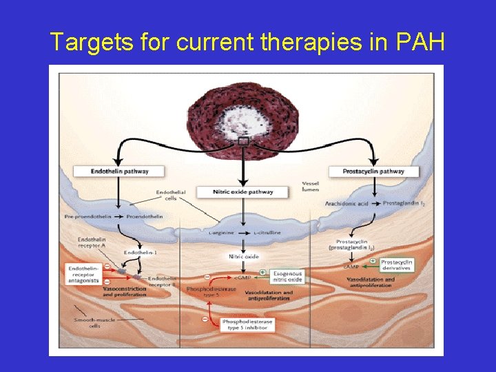 Targets for current therapies in PAH 
