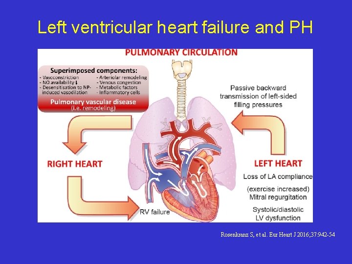 Left ventricular heart failure and PH Rosenkranz S, et al. Eur Heart J 2016;