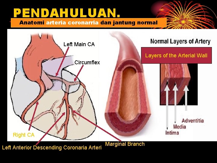 PENDAHULUAN. dan. Artery jantung. Anatomy normal The. Anatomi Normalarteria Heartcoronarria - Coronary Left Main