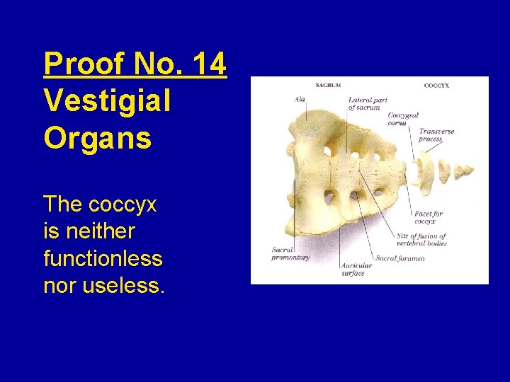 Proof No. 14 Vestigial Organs The coccyx is neither functionless nor useless. 