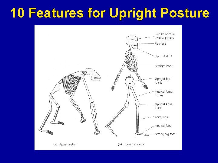 10 Features for Upright Posture 