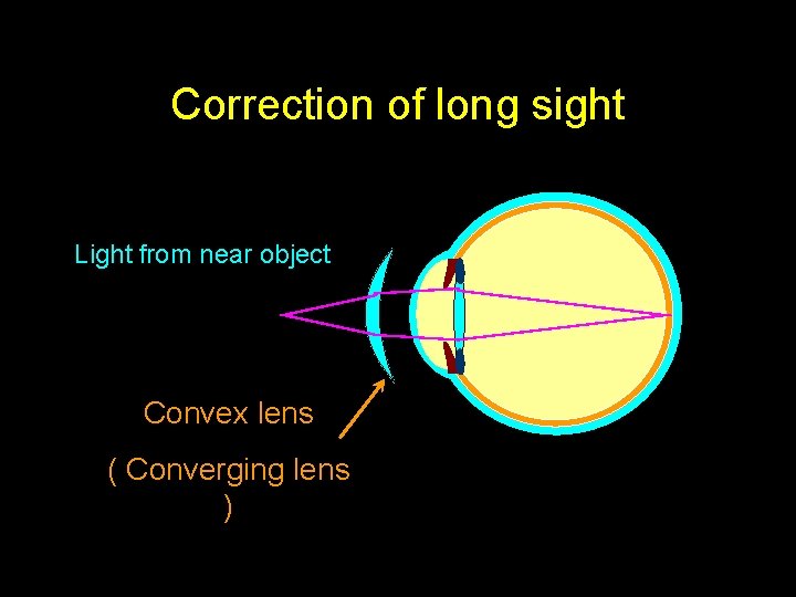 Correction of long sight Light from near object Convex lens ( Converging lens )