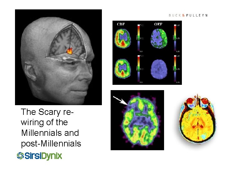 Cover this box with art The Scary rewiring of the Millennials and post-Millennials 