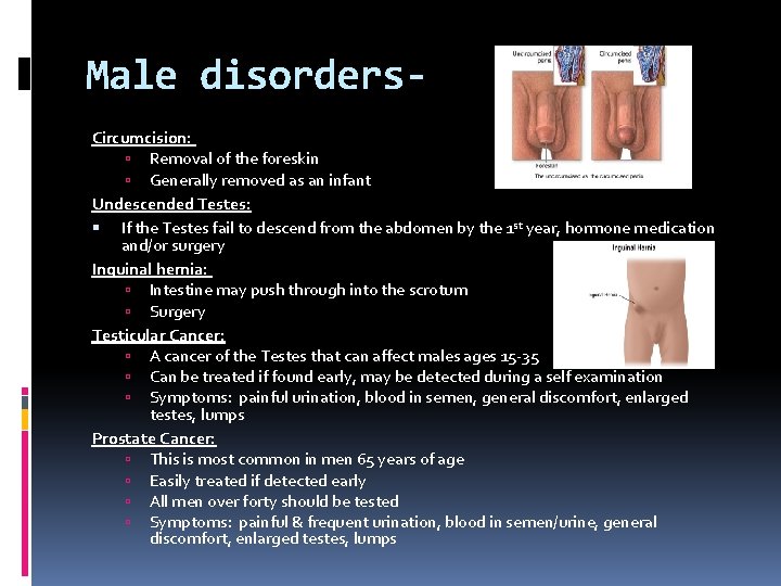 Male disorders. Circumcision: Removal of the foreskin Generally removed as an infant Undescended Testes: Male disorders. Circumcision: Removal of the foreskin Generally removed as an infant Undescended Testes: