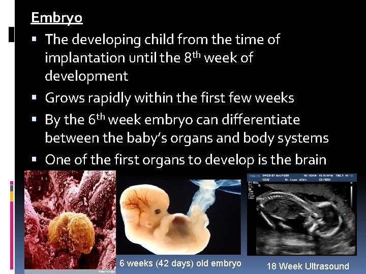 Embryo The developing child from the time of implantation until the 8 th week Embryo The developing child from the time of implantation until the 8 th week
