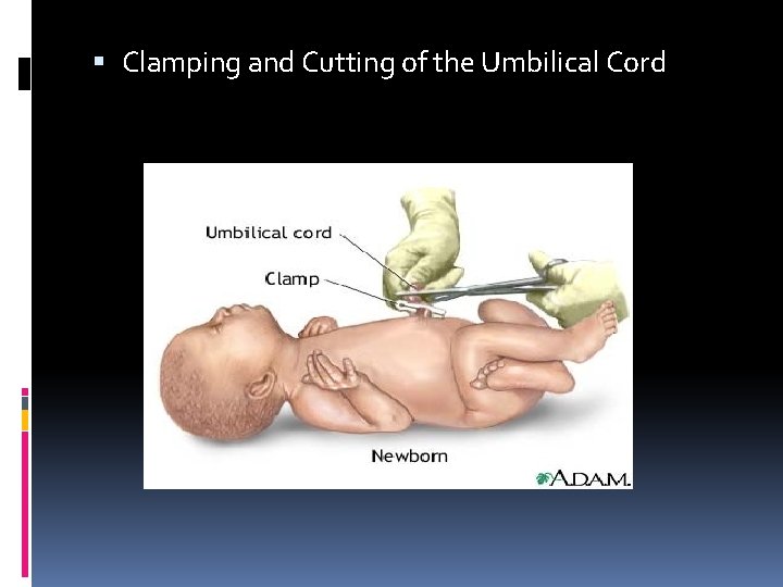Clamping and Cutting of the Umbilical Cord Clamping and Cutting of the Umbilical Cord
