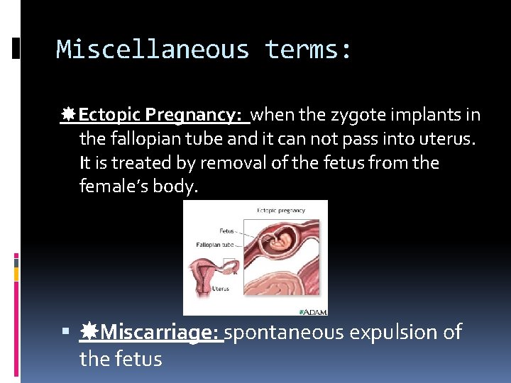 Miscellaneous terms: Ectopic Pregnancy: when the zygote implants in the fallopian tube and it Miscellaneous terms: Ectopic Pregnancy: when the zygote implants in the fallopian tube and it