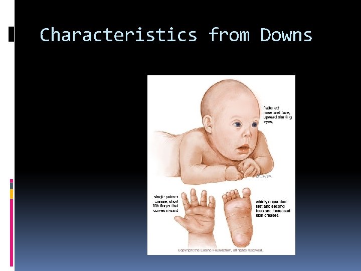 Characteristics from Downs Characteristics from Downs