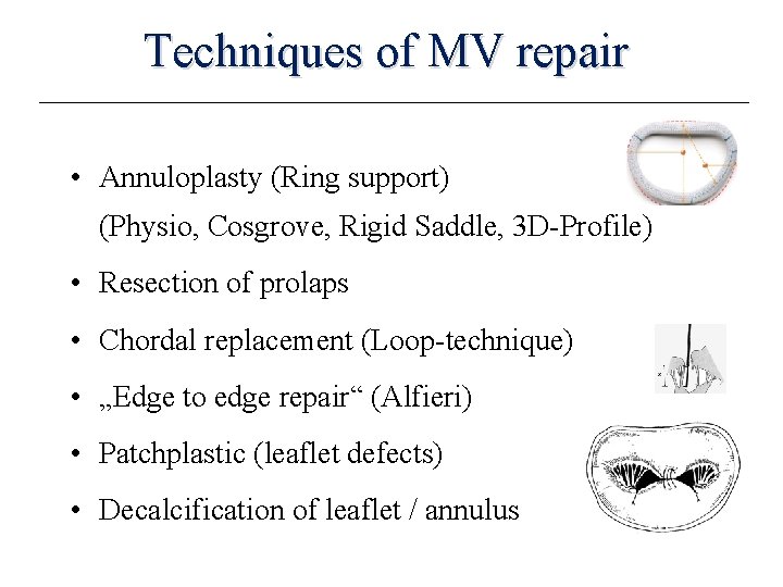 Techniques of MV repair • Annuloplasty (Ring support) (Physio, Cosgrove, Rigid Saddle, 3 D-Profile)