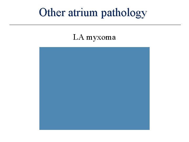 Other atrium pathology LA myxoma 