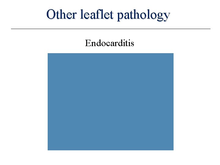 Other leaflet pathology Endocarditis 