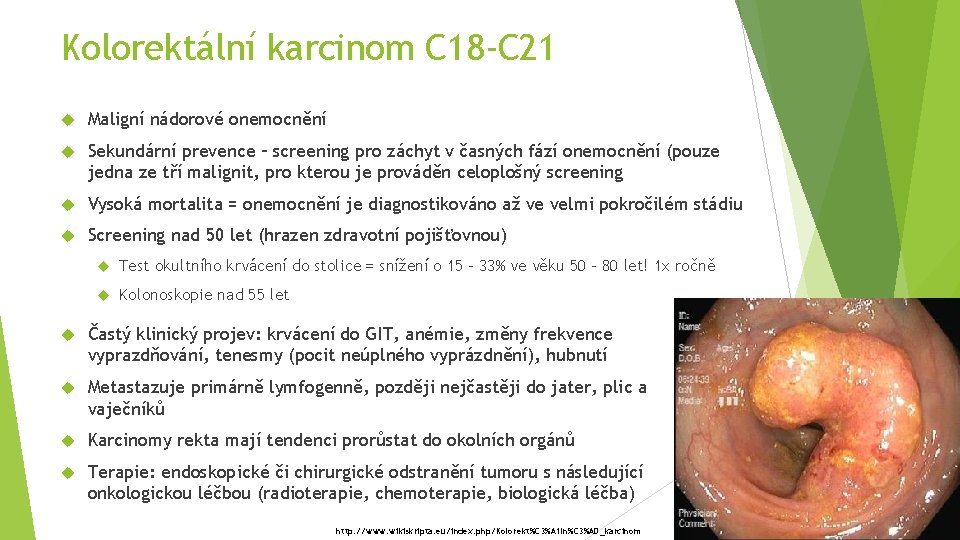 Kolorektální karcinom C 18 -C 21 Maligní nádorové onemocnění Sekundární prevence – screening pro