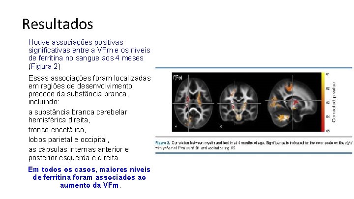 Resultados Houve associações positivas significativas entre a VFm e os níveis de ferritina no