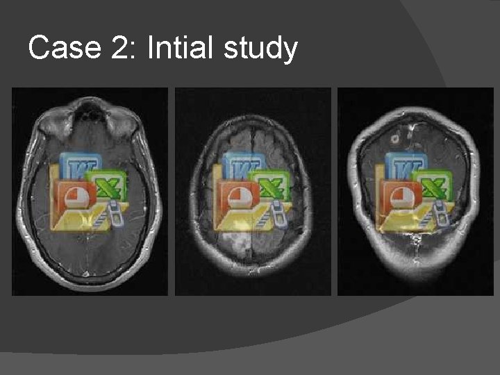 Case 2: Intial study 