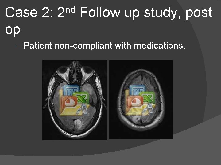 Case 2: op nd 2 Follow up study, post Patient non-compliant with medications. 