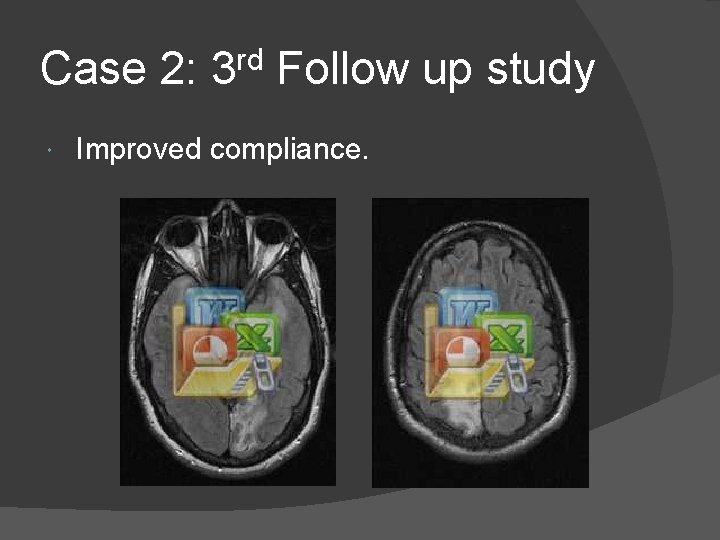 Case 2: 3 rd Follow up study Improved compliance. 