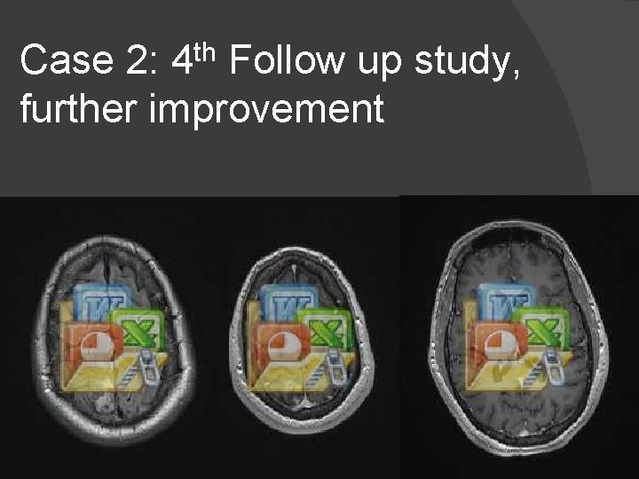 Case 2: 4 th Follow up study, further improvement 