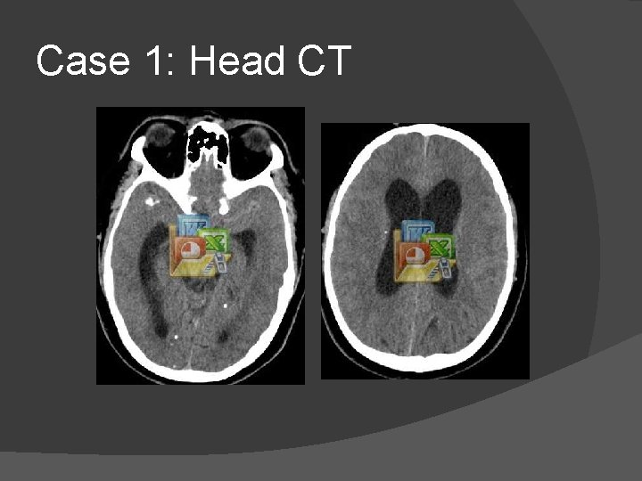 Case 1: Head CT 