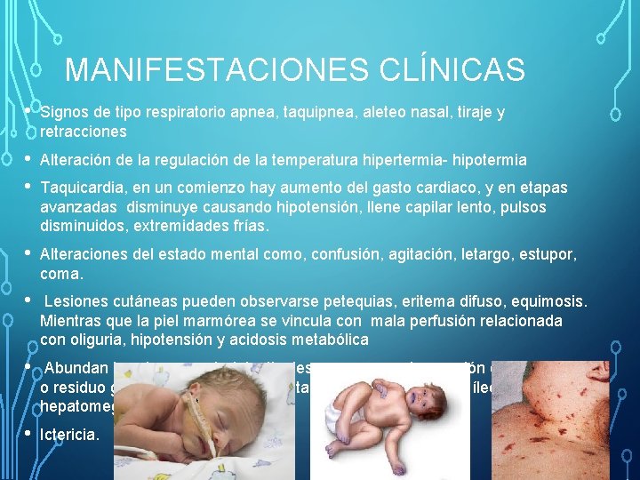 MANIFESTACIONES CLÍNICAS • Signos de tipo respiratorio apnea, taquipnea, aleteo nasal, tiraje y retracciones