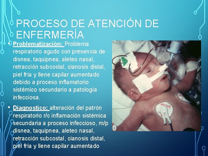 PROCESO DE ATENCIÓN DE ENFERMERÍA • Problematización: Problema respiratorio agudo con presencia de disnea,