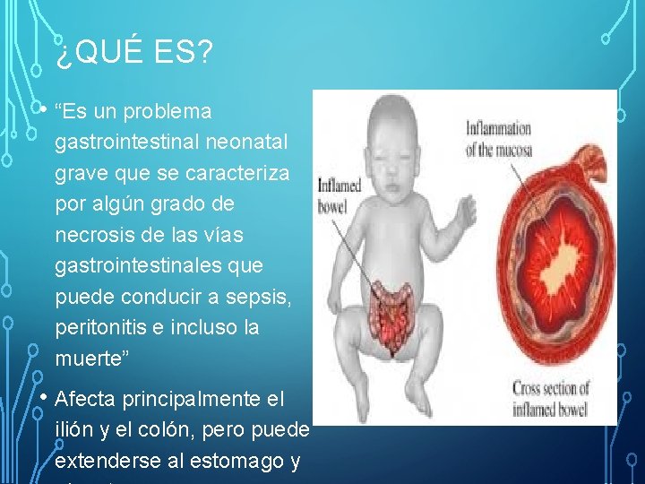 ¿QUÉ ES? • “Es un problema gastrointestinal neonatal grave que se caracteriza por algún