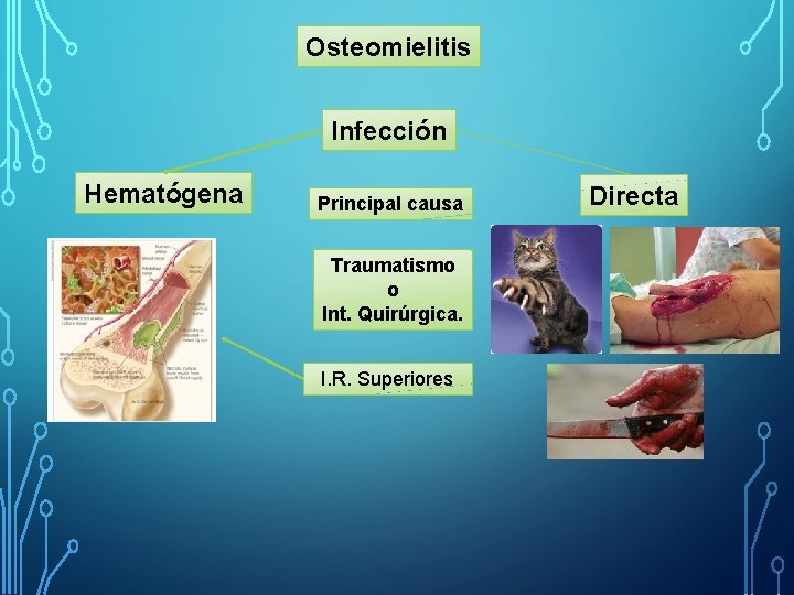 Osteomielitis Infección Hematógena Principal causa Traumatismo o Int. Quirúrgica. I. R. Superiores Directa 