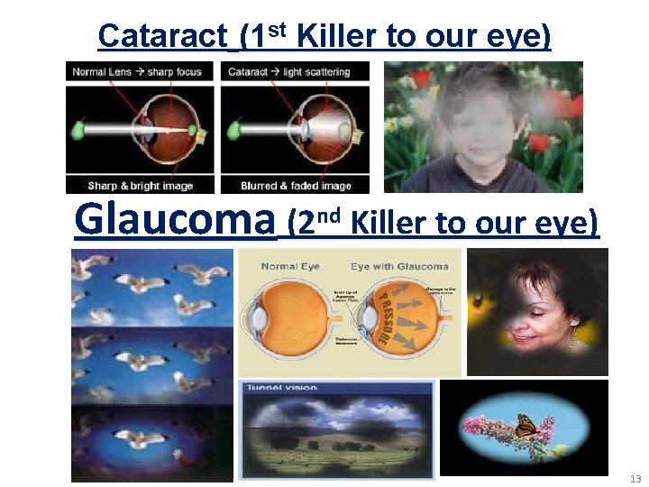 Cataract (1 st Killer to our eye) Glaucoma (2 nd Killer to our eye)