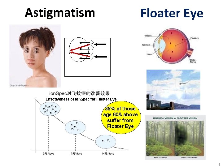 Astigmatism Floater Eye Effectiveness of ion. Spec for Floater Eye 35% of those age