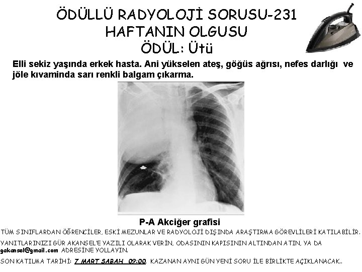 ÖDÜLLÜ RADYOLOJİ SORUSU-231 HAFTANIN OLGUSU ÖDÜL: Ütü Elli sekiz yaşında erkek hasta. Ani yükselen