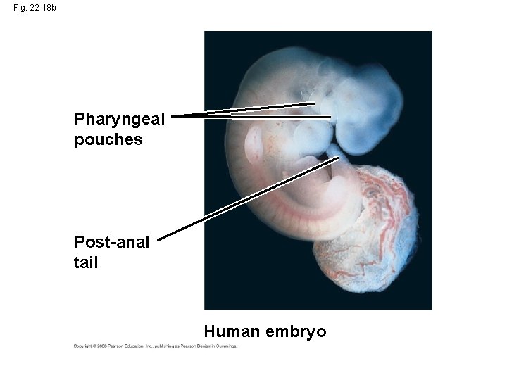 Fig. 22 -18 b Pharyngeal pouches Post-anal tail Human embryo 