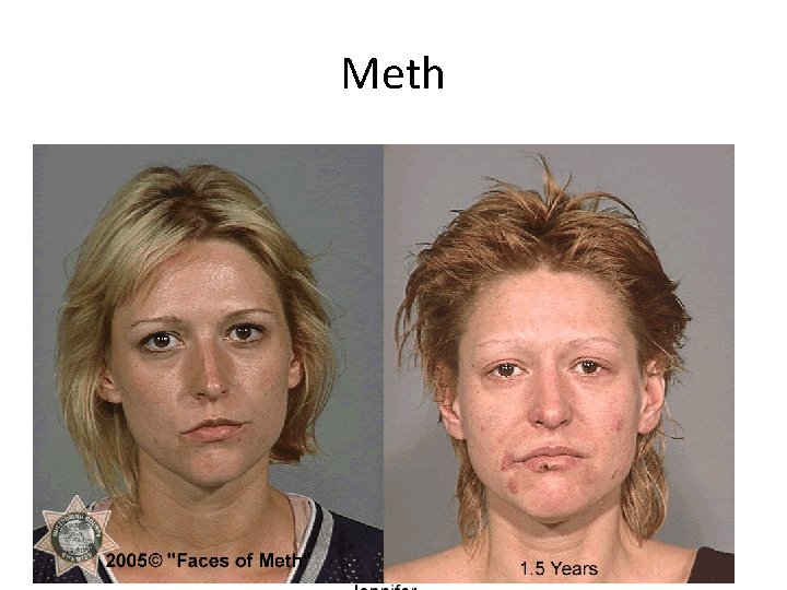 Meth 