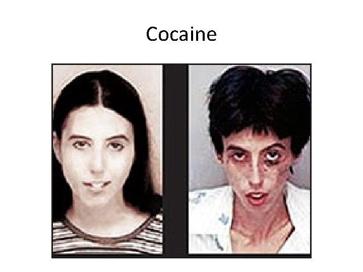 Cocaine 