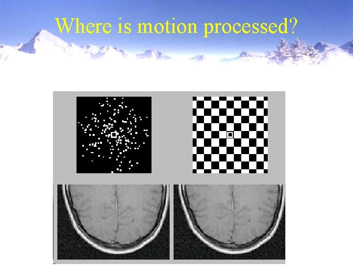 Where is motion processed? 