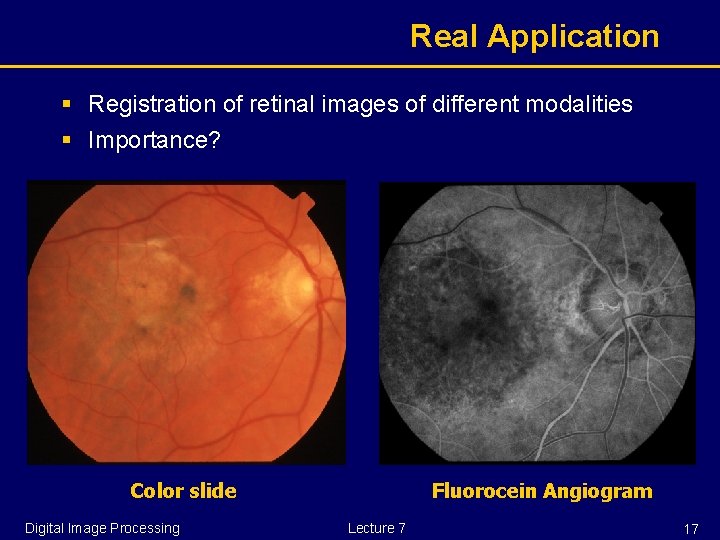 Real Application § Registration of retinal images of different modalities § Importance? Color slide