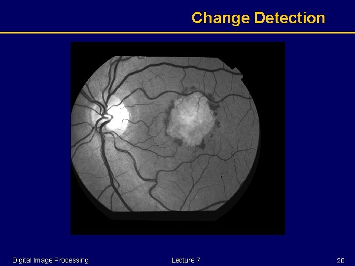 Change Detection Digital Image Processing Lecture 7 20 