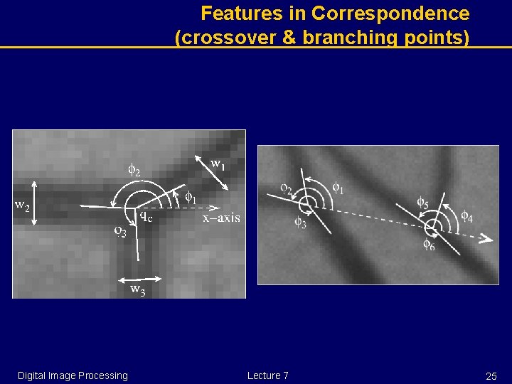 Features in Correspondence (crossover & branching points) Digital Image Processing Lecture 7 25 