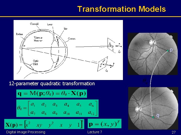 Transformation Models p 12 -parameter quadratic transformation q Digital Image Processing Lecture 7 27