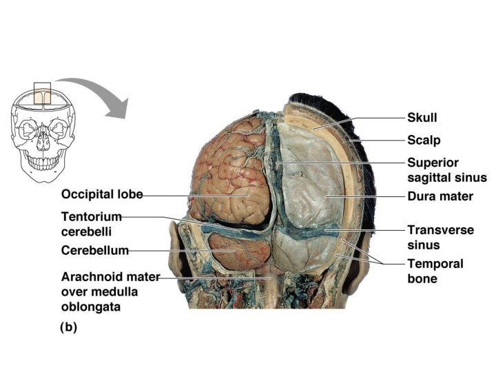 Cerebellum and other brain parts Copyright © 2006 Pearson Education, Inc. , publishing as