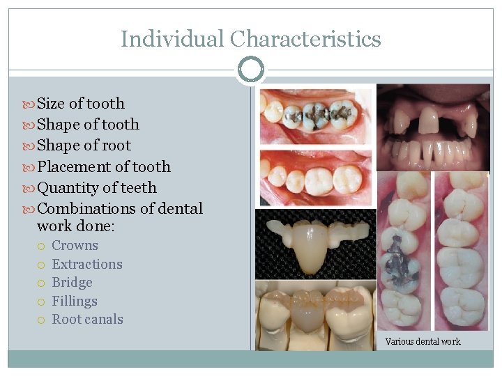 Individual Characteristics Size of tooth Shape of root Placement of tooth Quantity of teeth