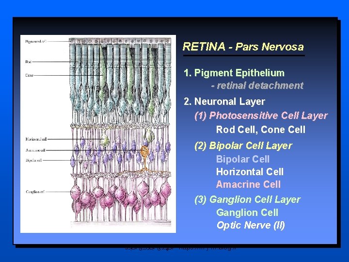 RETINA - Pars Nervosa 1. Pigment Epithelium - retinal detachment 2. Neuronal Layer (1)