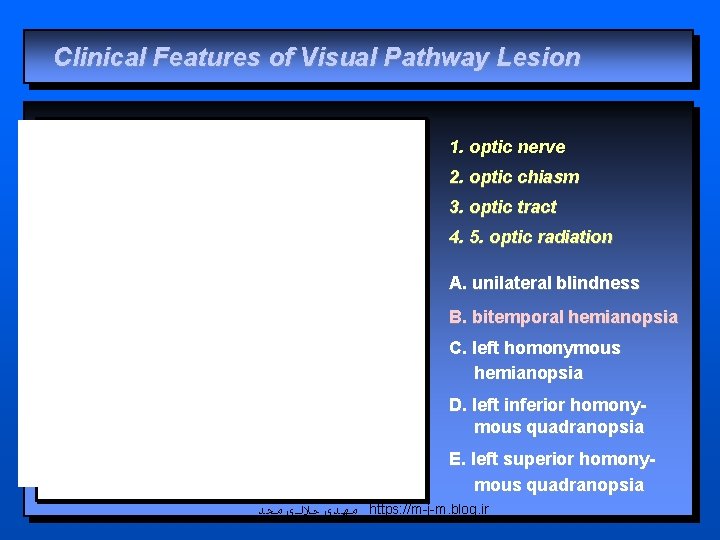 Clinical Features of Visual Pathway Lesion 1. optic nerve 2. optic chiasm 3. optic