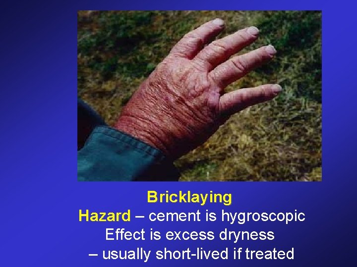 Bricklaying Hazard – cement is hygroscopic Effect is excess dryness – usually short-lived if