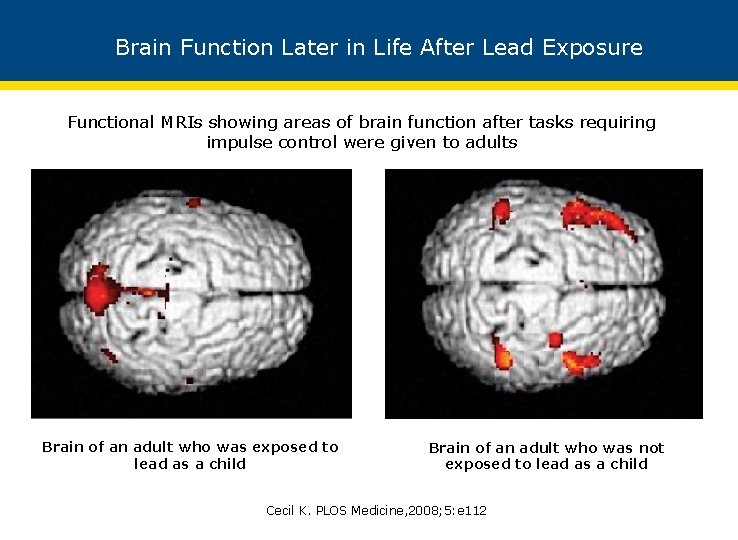 Brain Function Later in Life After Lead Exposure Functional MRIs showing areas of brain