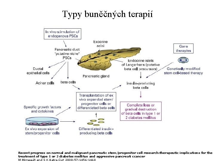 Typy buněčných terapií Recent progress on normal and malignant pancreatic stem/progenitor cell research: therapeutic
