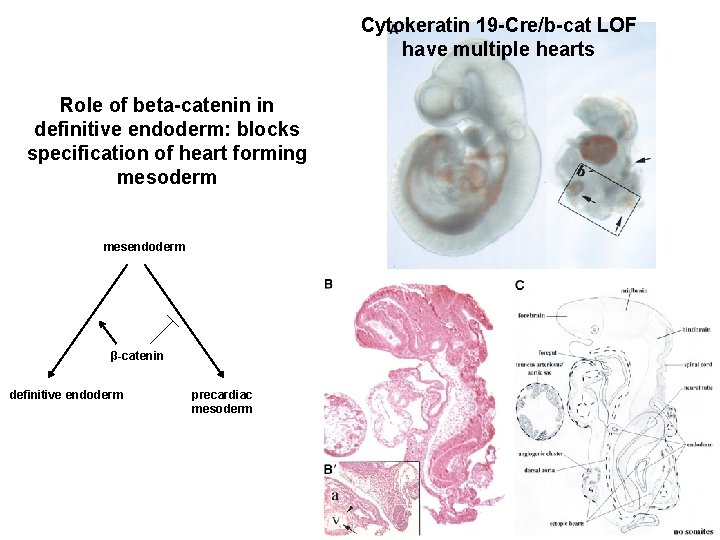 Cytokeratin 19 -Cre/b-cat LOF have multiple hearts Role of beta-catenin in definitive endoderm: blocks