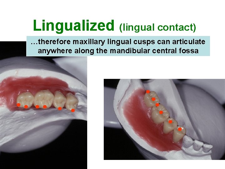 Lingualized (lingual contact) …therefore maxillary lingual cusps can articulate anywhere along the mandibular central