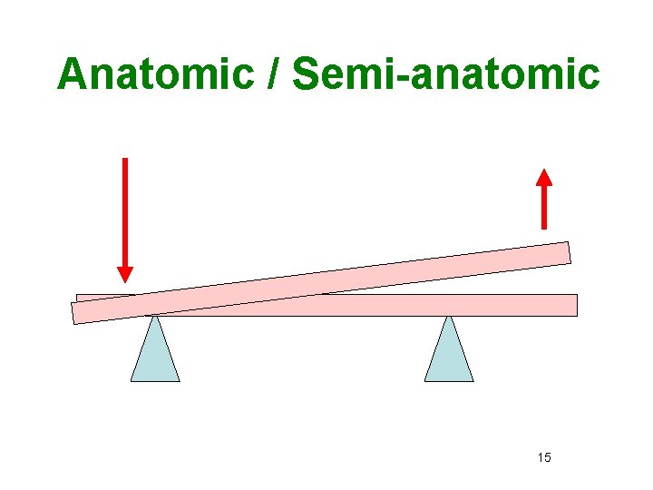Anatomic / Semi-anatomic Forces “buccal” to crest of ridge 15 